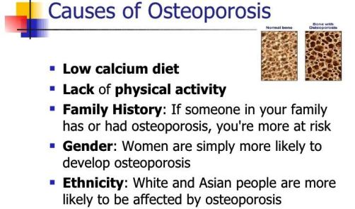 osteop cal-osteoporosis-prevention-and-management-5-728