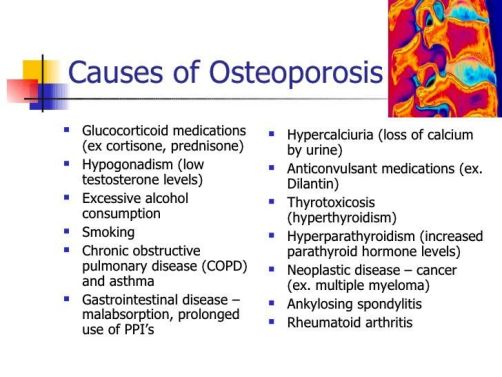osteop calosteoporosis-prevention-and-management-6-728