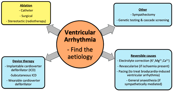 pvc ar-ven-gee-lim-ventricular-arrythmia