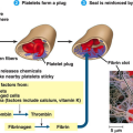 clotting simple diagram plug clot