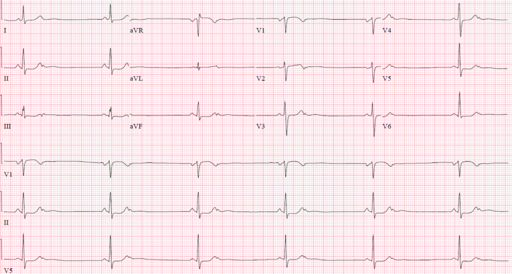 av Figure 1