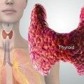 thyroid-symptoms-and-solutions-s2 (1)
