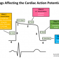 arrytm Cardiac_action_potential