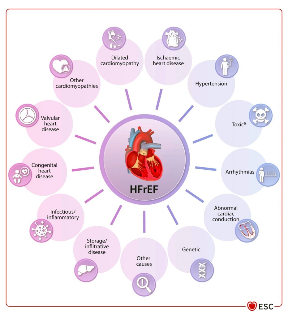 HF ehag100f5