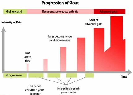 gout Progression-of-Gout