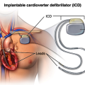 icd-GetImage