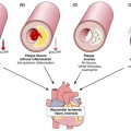 nstemi nihms900098f1