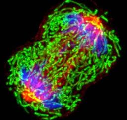 can dividing-breast-cancer-cell-article-only