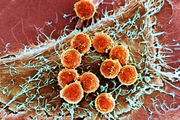 can t-lymphocytes-and-cancer-cell-sem-spl-3x2