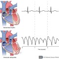 Heart - Open - Resized