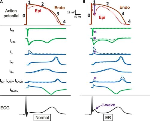 ΣΥΝΔΡΟΜΟ ΠΡΩΙΜΗΣ ΕΠΑΝΑΠΟΛΩΣΗΣ / EARLY REPOLARIZATION– J–WAVE SYNDROME  (ERS)