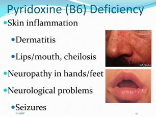 b6 pyridoxine-b6-deficiency27-l
