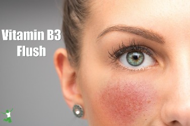 Red flushing cheeks are seen closeup, in the face of a stunning thirty something caucasian girl, permanent redness and small visible blood vessels, symptoms of rosacea with room for copy.