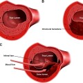 scad vvxxe523fig01 (1)