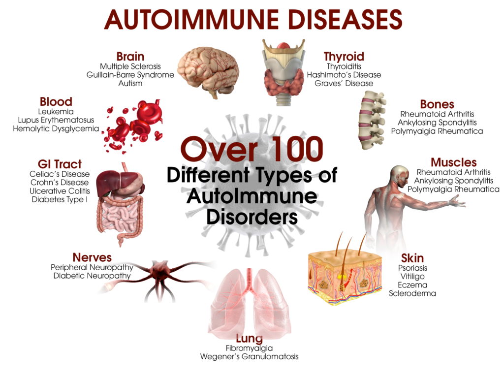 Auto Immune-1024x768