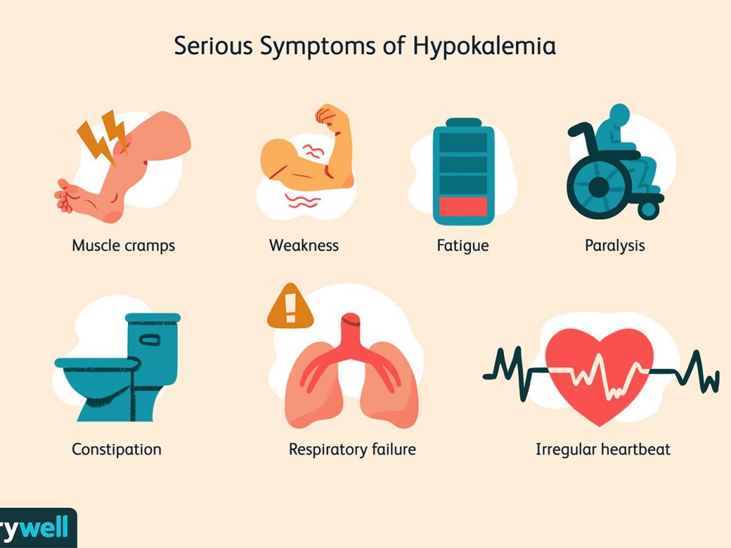 hypo kalemia-overview-and-more-5088594-Final-206f0d32929e4f579a89e93336ff953d